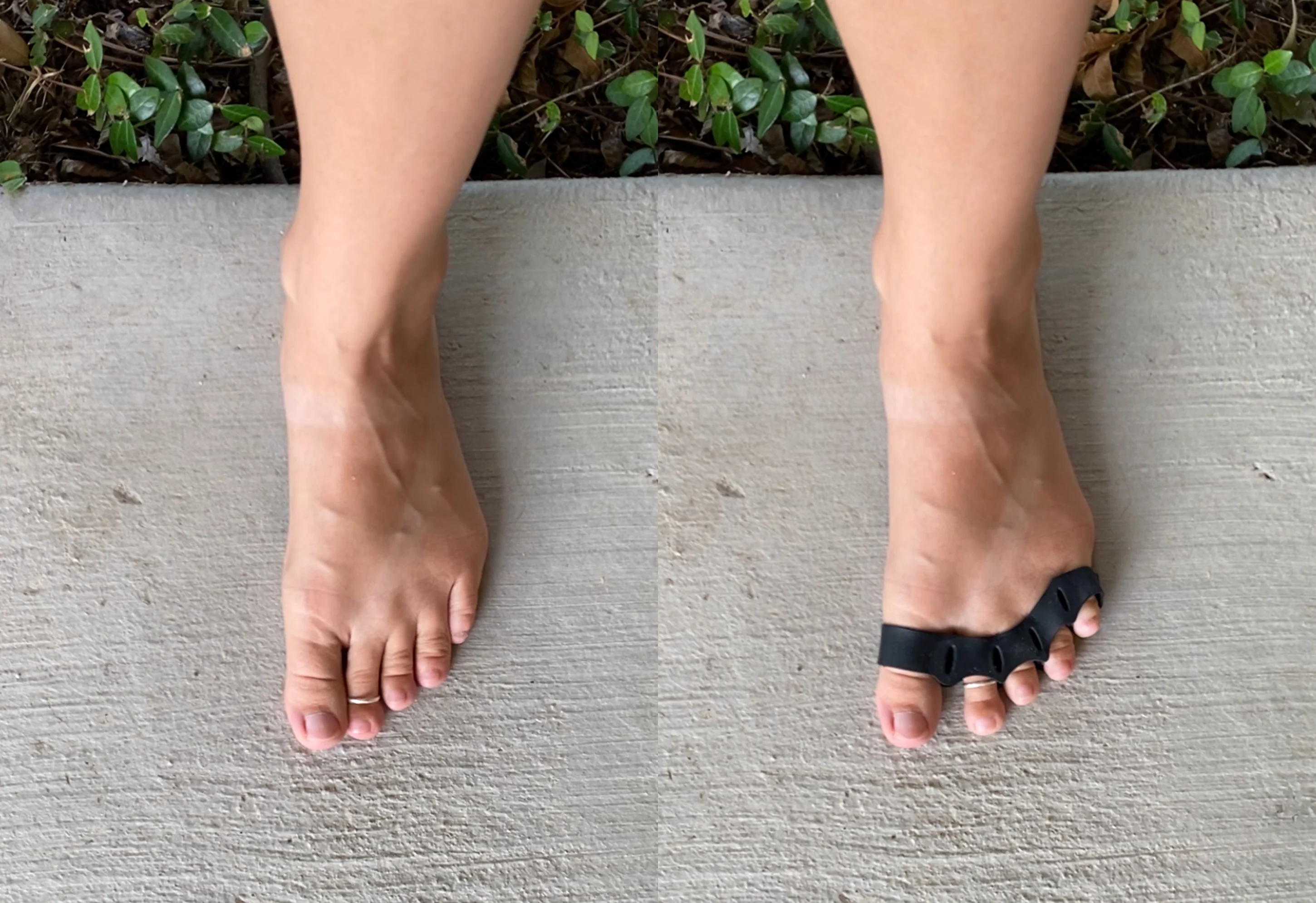 Athletic Toe Spacers - Image 5