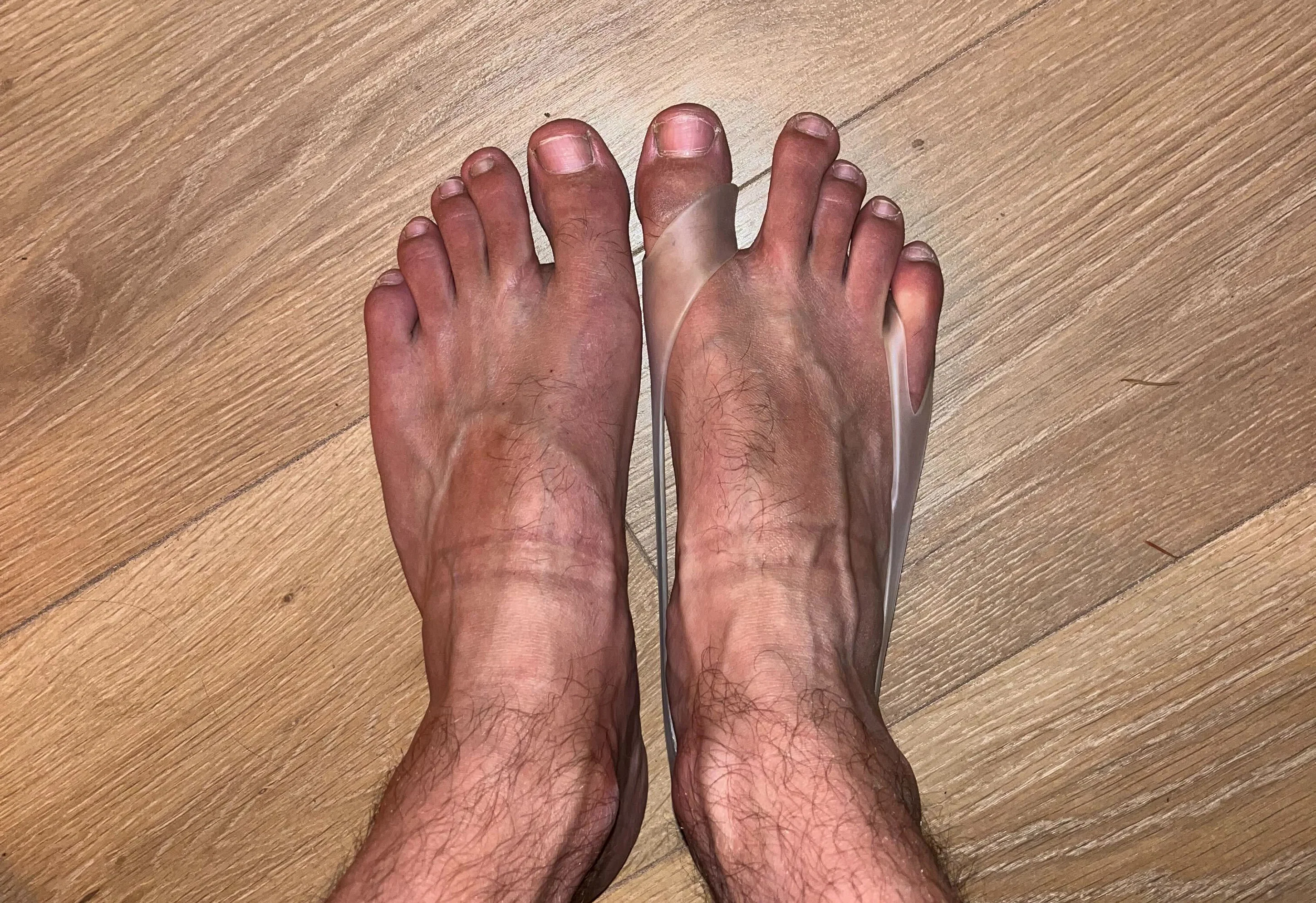 Toe Expanders - Image 10