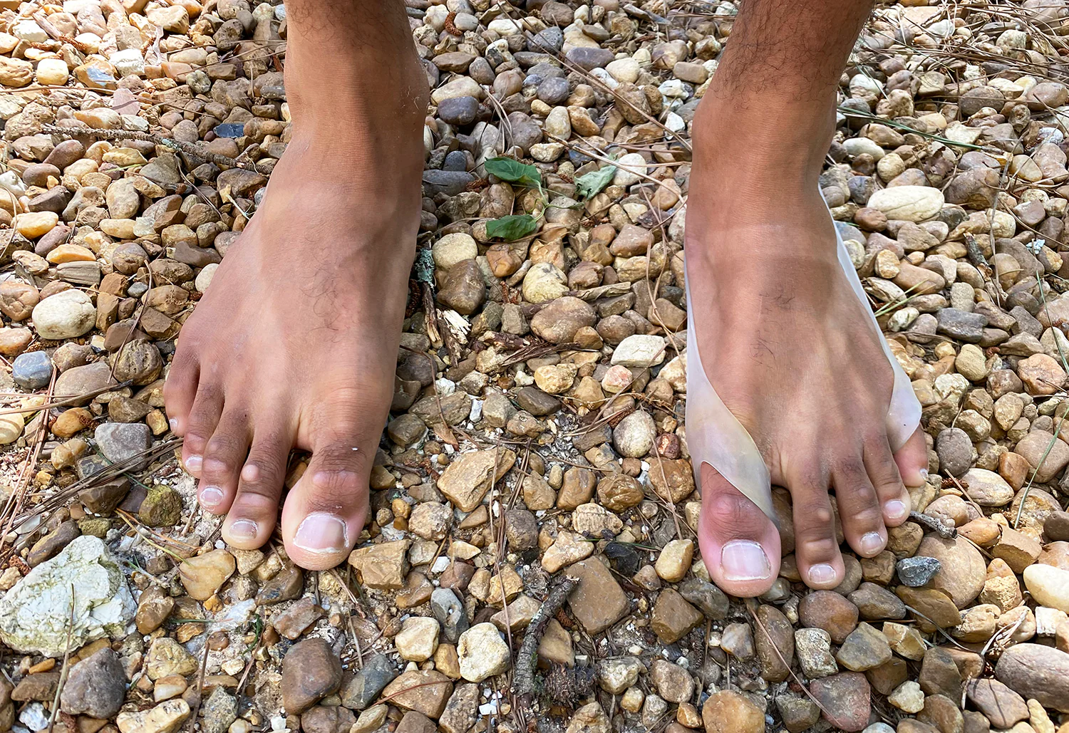 Toe Expanders - Image 8