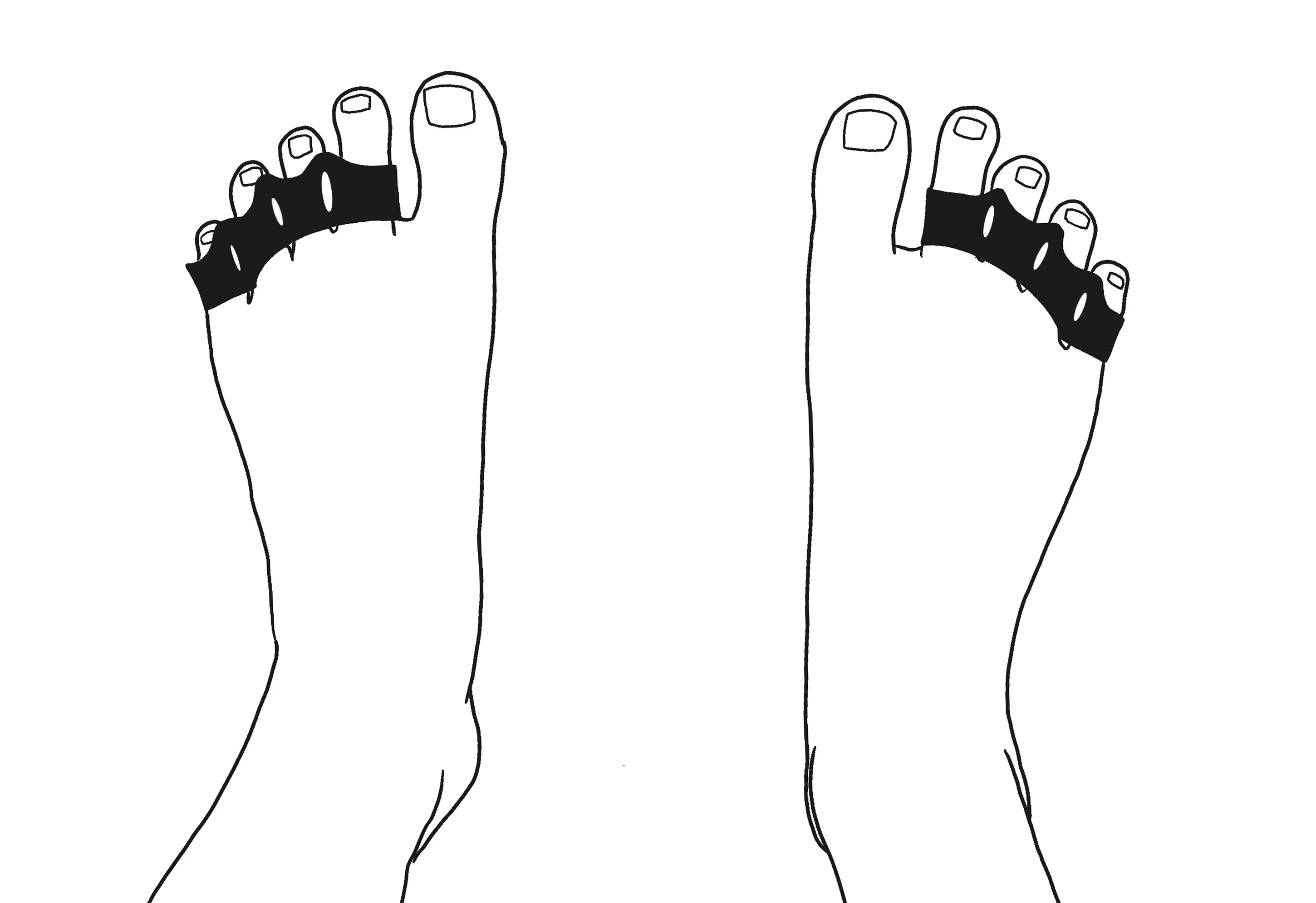 Mobility Toe Spacers - Image 6